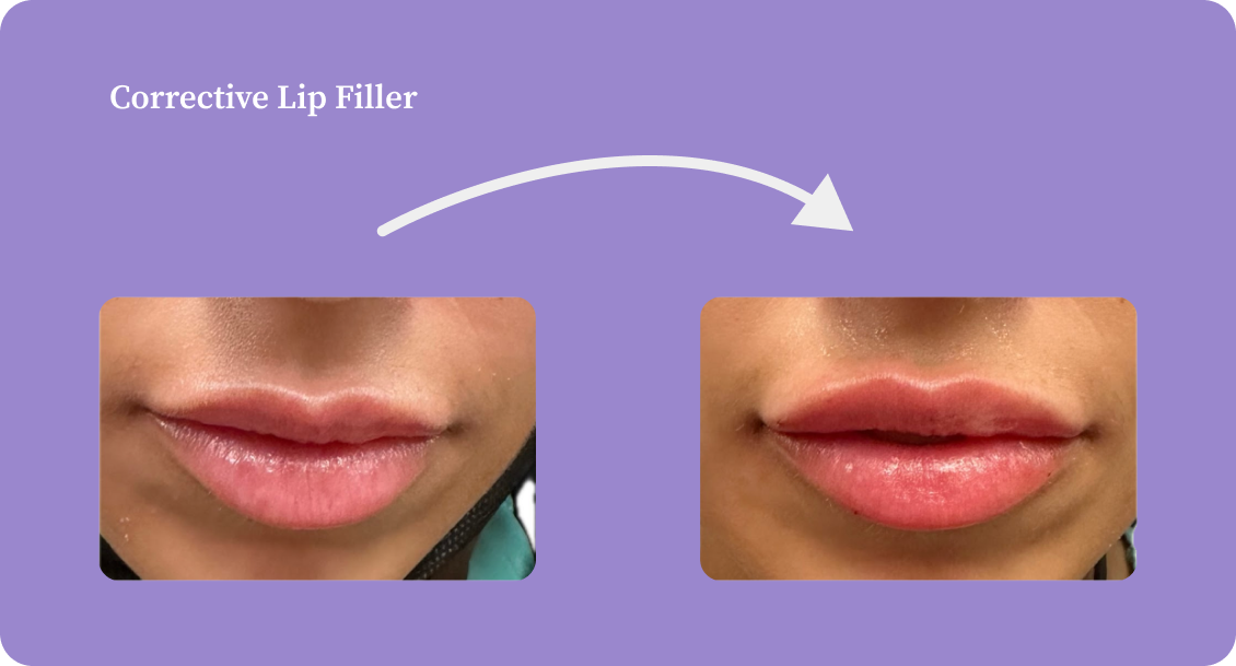 before and after